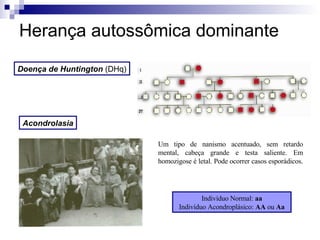 Herança autossômica dominante Doença de Huntington   (DHq) Um tipo de nanismo acentuado, sem retardo mental, cabeça grande e testa saliente. Em homozigose é letal. Pode ocorrer casos esporádicos.  Indivíduo Normal:  aa Indivíduo Acondroplásico:  AA  ou  Aa Acondrolasia 