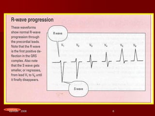 parameters of ekg interpretation-4 | PDF