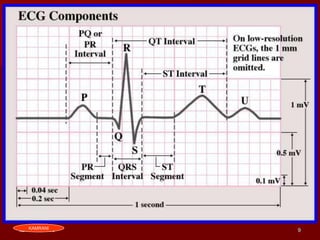 5 parameters of ekg interpretation1 | PDF