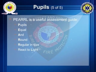 Pupils (5 of 5)
• PEARRL is a useful assessment guide:
– Pupils
– Equal
– And
– Round
– Regular in size
– React to Light
 