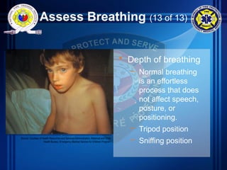 Assess Breathing (13 of 13)
• Depth of breathing
– Normal breathing
is an effortless
process that does
not affect speech,
posture, or
positioning.
– Tripod position
– Sniffing position
Source: Courtesy of Health Resources and Services Administration, Maternal and Child
Health Bureau, Emergency Medical Service for Children Program
 