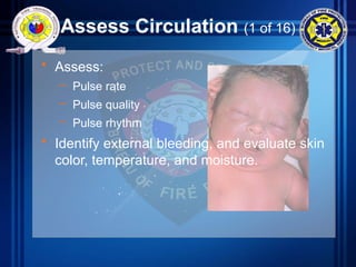 Assess Circulation (1 of 16)
• Assess:
– Pulse rate
– Pulse quality
– Pulse rhythm
• Identify external bleeding, and evaluate skin
color, temperature, and moisture.
 