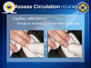 Assess Circulation (12 of 16)
• Capillary refill (cont’d)
– Should be restored to normal within 2 seconds
 