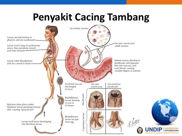 87 Gambar Penyakit Cacing Gelang Terbaik 87 Gambar Penyakit Cacing Gelang Terbaik
