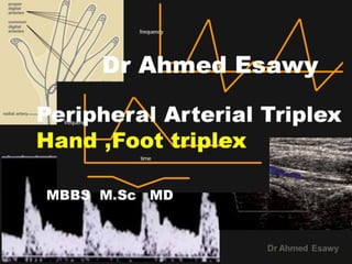 5 peripheral arterial triplex ultrasound  hand,foot triplex dr ahmed esawy