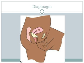 Diaphragm 