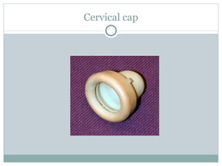 Cervical cap 