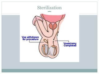 Sterilization 