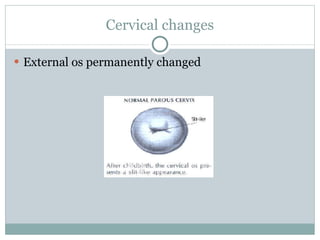 Cervical changes External os permanently changed 