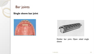 11/09/2025 107
Bar joints
Dolder bar joint. Open sided single
sleeve
Single sleeve bar joint
 