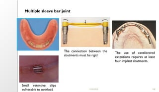 11/09/2025 108
Multiple sleeve bar joint
The connection between the
abutments must be rigid
The use of cantilevered
extensions requires at least
four implant abutments.
Small retentive clips
vulnerable to overload
 