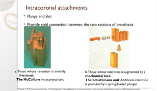 13
Intracoronal attachments
 Flange and slot
 Provide rigid connection between the two sections of prosthesis
11/09/2025
a. Those whose retention is entirely
frictional.
The McCollum intracoronal unit
b.Those whose retention is augmented by a
mechanical lock
The Schatzmann unit.Additional retention
is provided by a spring-loaded plunger
Preiskel H.W. Precision attachments in Prosthodontics:The applications of intracoronal and extracoronal attachments, volume 1, Quintessence books.
 