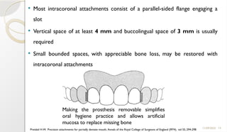 14
 Most intracoronal attachments consist of a parallel-sided flange engaging a
slot
 Vertical space of at least 4 mm and buccolingual space of 3 mm is usually
required
 Small bounded spaces, with appreciable bone loss, may be restored with
intracoronal attachments
11/09/2025
Making the prosthesis removable simplifies
oral hygiene practice and allows artificial
mucosa to replace missing bone
Preiskel H.W. Precision attachments for partially dentate mouth, Annals of the Royal College of Surgeons of England (I974), vol 55, 294-298
 