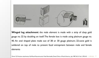 17
11/09/2025
Winged lug attachment: the male element is made with a strip of clasp gold
gauge no. 22 by doubling on itself.The female box is made using platinum gauge no.
40. An oval shaped plate made out of 38 or 30 gauge platinum; 22-carat gold is
soldered on top of male to prevent food entrapment between male and female
elements
Zinner I.D. Precision attachments, Full-Mouth Reconstruction: Fixed Removable, Dental Clinics of North America, July 1987,Vol.31, No. 3, 395-415
 