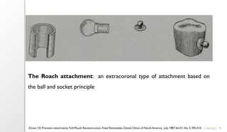 18
11/09/2025
The Roach attachment: an extracoronal type of attachment based on
the ball and socket principle
Zinner I.D. Precision attachments, Full-Mouth Reconstruction: Fixed Removable, Dental Clinics of North America, July 1987,Vol.31, No. 3, 395-415
 
