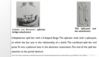 20
11/09/2025
Gollobin and Bernstein’s split-bar
bridge attachment
The split-post and
bar attachment
Iridoplatinum spilt bar with a V-shaped flange.The split-bar ends with a split-post,
to which the bar acts in the relationship of a shank.The combined split bar and
posts fit into a platinum box in the abutment restoration.The end of the spilt bar
attaches to the partial denture
Zinner I.D. Precision attachments, Full-Mouth Reconstruction: Fixed Removable, Dental Clinics of North America, July 1987,Vol.31, No. 3, 395-415
 
