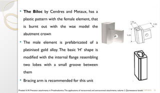 32
 The Biloc by Cendres and Metaux, has a
plastic pattern with the female element, that
is burnt out with the wax model the
abutment crown
 The male element is prefabricated of a
platinised gold alloy. The basic ‘H’ shape is
modified with the internal flange resembling
two lobes with a small groove between
them
 Bracing arm is recommended for this unit
11/09/2025
Preiskel H.W. Precision attachments in Prosthodontics:The applications of intracoronal and extracoronal attachments, volume 1, Quintessence books
 