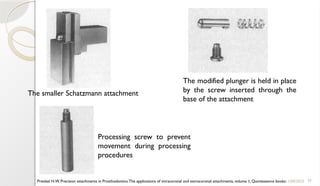 35
11/09/2025
Preiskel H.W. Precision attachments in Prosthodontics:The applications of intracoronal and extracoronal attachments, volume 1, Quintessence books
The modified plunger is held in place
by the screw inserted through the
base of the attachment
The smaller Schatzmann attachment
Processing screw to prevent
movement during processing
procedures
 