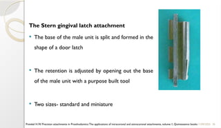 36
The Stern gingival latch attachment
 The base of the male unit is split and formed in the
shape of a door latch
 The retention is adjusted by opening out the base
of the male unit with a purpose built tool
 Two sizes- standard and miniature
11/09/2025
Preiskel H.W. Precision attachments in Prosthodontics:The applications of intracoronal and extracoronal attachments, volume 1, Quintessence books
 