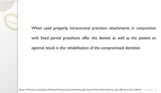 50
When used properly, intracoronal precision attachments in conjunction
with fixed partial prosthesis offer the dentist as well as the patient an
optimal result in the rehabilitation of the compromised dentition
11/09/2025
Zinner I.D. Precision attachments, Full-Mouth Reconstruction: Fixed Removable, Dental Clinics of North America, July 1987,Vol.31, No. 3, 395-415
 