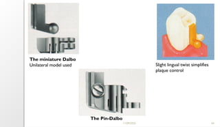 11/09/2025 64
The Pin-Dalbo
Slight lingual twist simplifies
plaque control
The miniature Dalbo
Unilateral model used
 