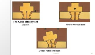11/09/2025 66
The Ceka attachment
At rest Under vertical load
Under rotational load
 