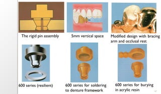 11/09/2025 67
The rigid pin assembly 5mm vertical space Modified design with bracing
arm and occlusal rest
600 series (resilient) 600 series for soldering
to denture framework
600 series for burying
in acrylic resin
 