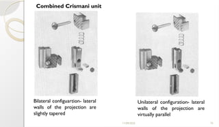 11/09/2025 75
Combined Crismani unit
Bilateral configuartion- lateral
walls of the projection are
slightly tapered
Unilateral configuration- lateral
walls of the projection are
virtually parallel
 