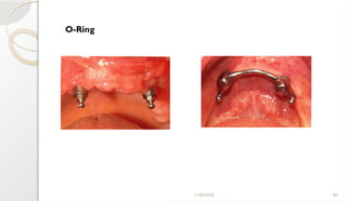 11/09/2025 84
O-Ring
 