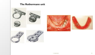 11/09/2025 91
The Rothermann unit
 