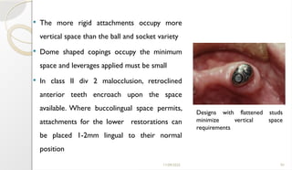 11/09/2025 93
 The more rigid attachments occupy more
vertical space than the ball and socket variety
 Dome shaped copings occupy the minimum
space and leverages applied must be small
 In class II div 2 malocclusion, retroclined
anterior teeth encroach upon the space
available. Where buccolingual space permits,
attachments for the lower restorations can
be placed 1-2mm lingual to their normal
position
Designs with flattened studs
minimize vertical space
requirements
 