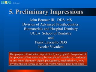 5. Preliminary Impressions John Beumer III,  DDS, MS Division of Advanced Prosthodontics, Biomaterials and Hospital Dentistry UCLA  School of Dentistry and Frank Lauciello DDS Ivoclar Vivadent This program of instruction is protected by copyright ©.  No portion of this program of instruction may be reproduced, recorded or transferred by any means electronic, digital, photographic, mechanical etc., or by any information storage or retrieval system, without prior permission. 