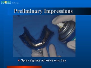 Preliminary Impressions  <ul><li>Spray alginate adhesive onto tray </li></ul>