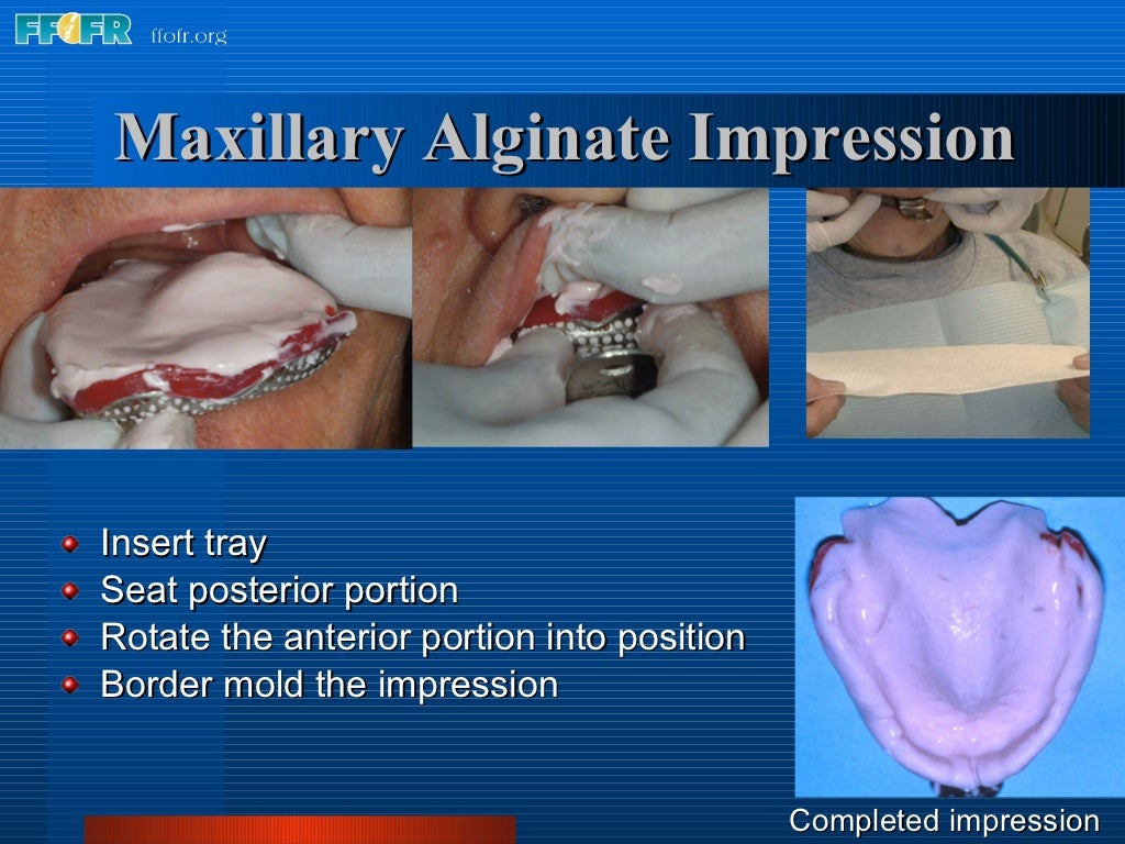 5.preliminary impressions