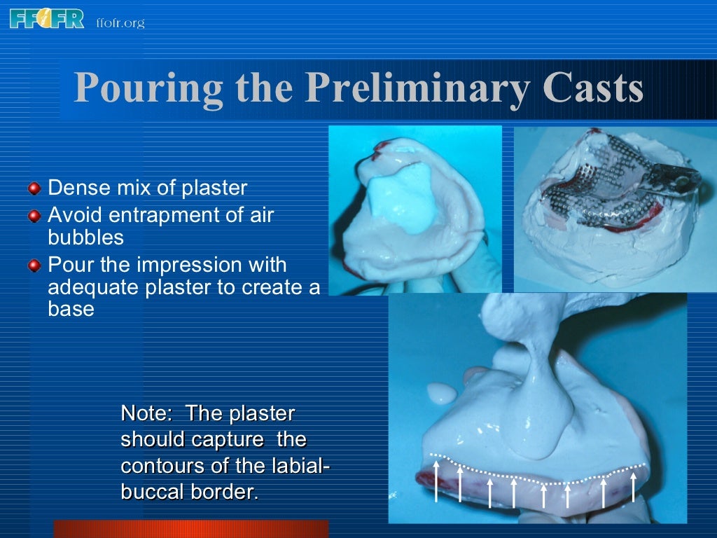 5.preliminary impressions