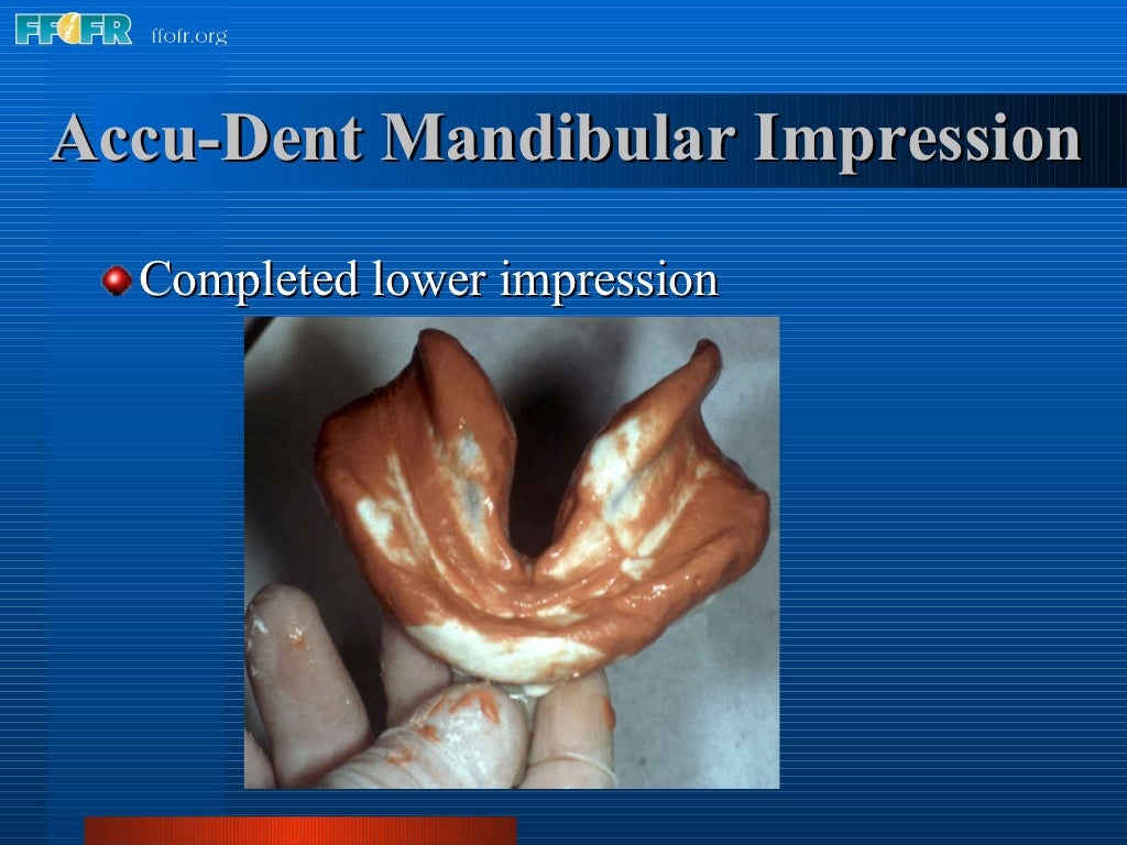 5.preliminary impressions