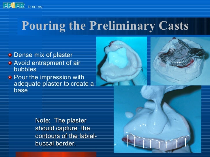 5.preliminary impressions