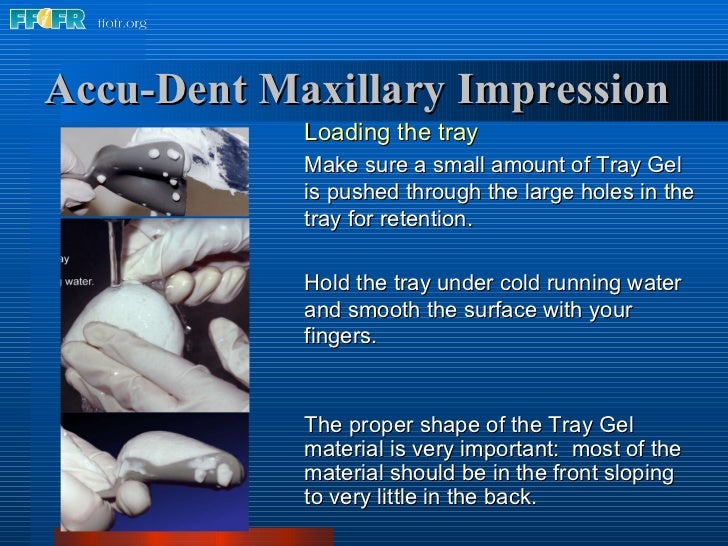 5.preliminary impressions