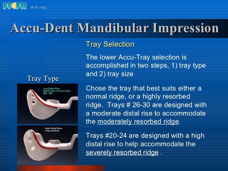 5.preliminary impressions