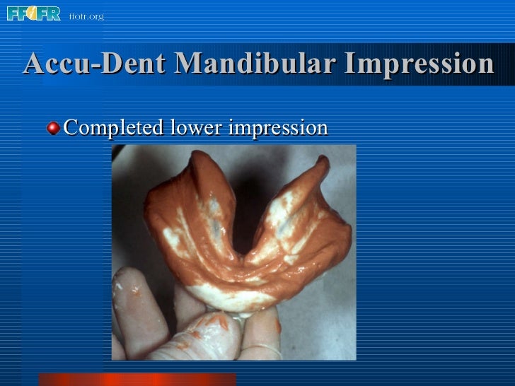 5.preliminary impressions