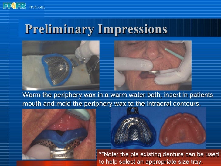 5.preliminary impressions