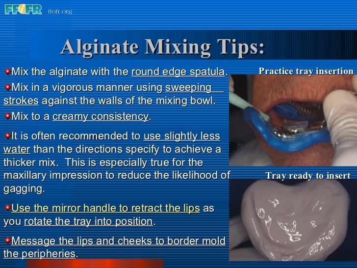 5.preliminary impressions