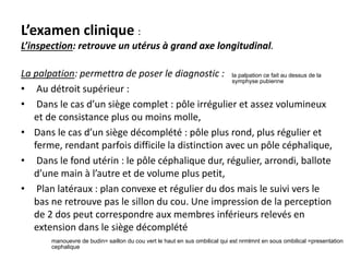 L’examen clinique :
L’inspection: retrouve un utérus à grand axe longitudinal.
La palpation: permettra de poser le diagnostic :
• Au détroit supérieur :
• Dans le cas d’un siège complet : pôle irrégulier et assez volumineux
et de consistance plus ou moins molle,
• Dans le cas d’un siège décomplété : pôle plus rond, plus régulier et
ferme, rendant parfois difficile la distinction avec un pôle céphalique,
• Dans le fond utérin : le pôle céphalique dur, régulier, arrondi, ballote
d’une main à l’autre et de volume plus petit,
• Plan latéraux : plan convexe et régulier du dos mais le suivi vers le
bas ne retrouve pas le sillon du cou. Une impression de la perception
de 2 dos peut correspondre aux membres inférieurs relevés en
extension dans le siège décomplété
la palpation ce fait au dessus de la
symphyse pubienne
manouevre de budin= saillon du cou vert le haut en sus ombilical qui est nrmlmnt en sous ombilical =presentation
cephalique
 