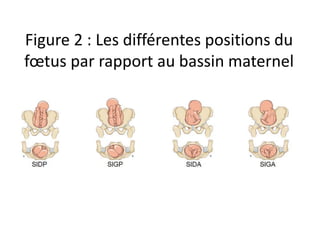 Figure 2 : Les différentes positions du
fœtus par rapport au bassin maternel
 