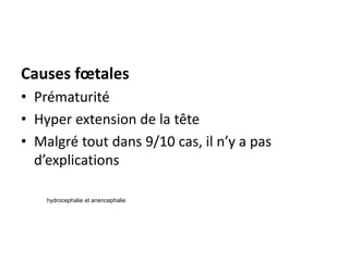 Causes fœtales
• Prématurité
• Hyper extension de la tête
• Malgré tout dans 9/10 cas, il n’y a pas
d’explications
hydrocephalie et anencephalie
 