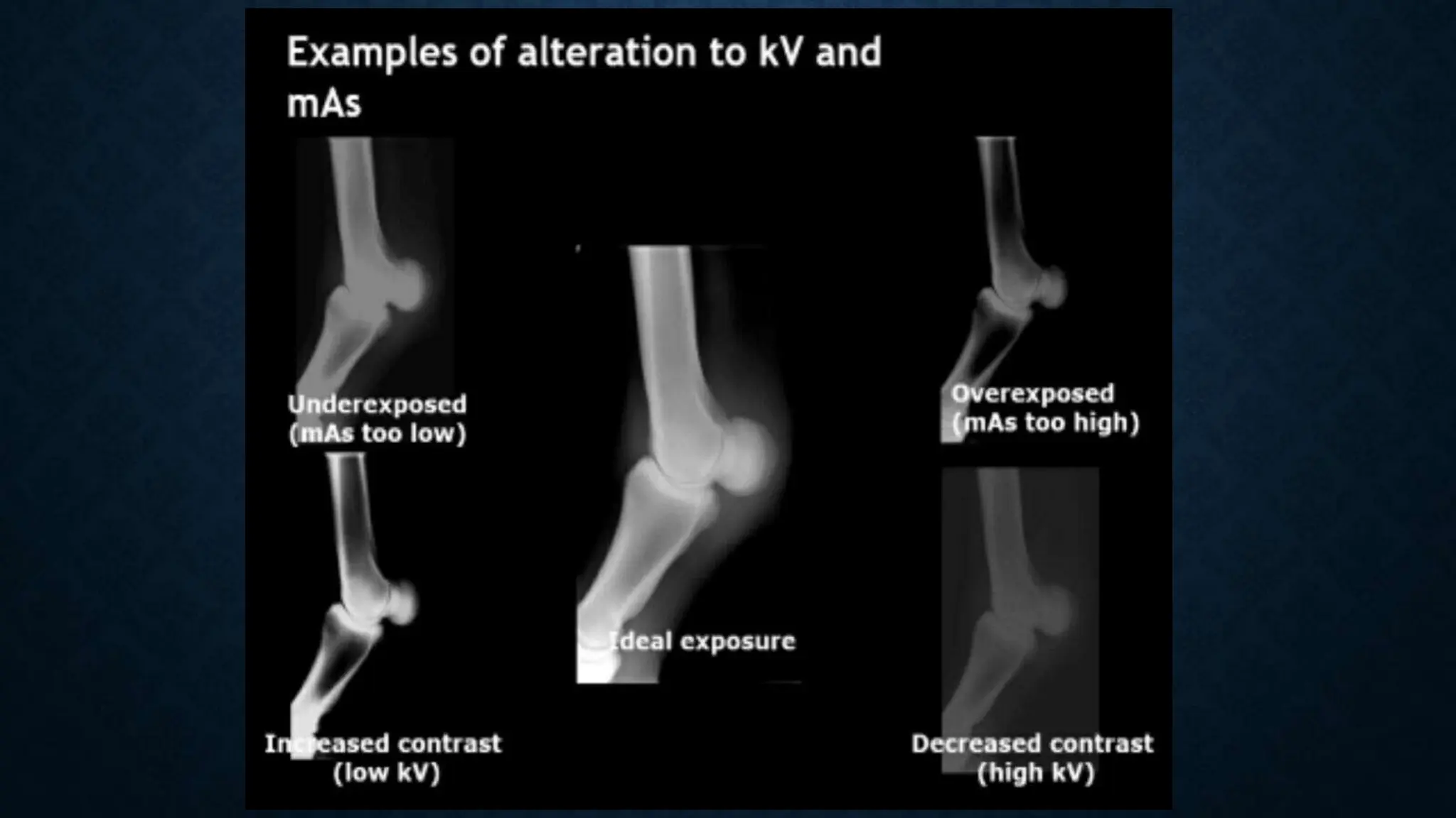 Radiographic Artifacts in Diagnostic Imaging Techniques | PPTX