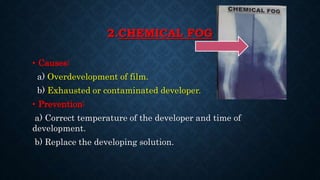 2.CHEMICAL FOG
• Causes:
a) Overdevelopment of film.
b) Exhausted or contaminated developer.
• Prevention:
a) Correct temperature of the developer and time of
development.
b) Replace the developing solution.
 