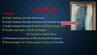 3.LIGHT FOG
• Causes:
a) Light leakage into the dark room.
b) Light leakage through cassette and transfer box.
c) Light leakage through broken lead film storage box.
d) Faulty safe light. i) Bulb too bright.
ii) Cracked or faded filter.
e) Prolonged inspection of film during development.
f) Turning light 'on' before proper fixation of the film.
 