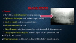 BLACK SPOTS
• Causes:
a) Two films stuck together during fixation.
b) Splash of developer on film before processing.
c) Dust or liquid on the processed film.
d) Linear scratches on film.
e) Light leakage into film storage box or into poorly fitting cassette.
f) Dropping of water droplets from hangers on the processed film
during drying process.
g) Sharp pressure on film or bending of film before development.
 