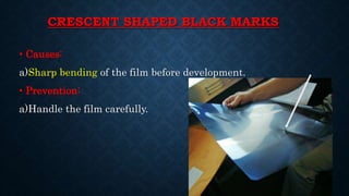 CRESCENT SHAPED BLACK MARKS
• Causes:
a)Sharp bending of the film before development.
• Prevention:
a)Handle the film carefully.
 